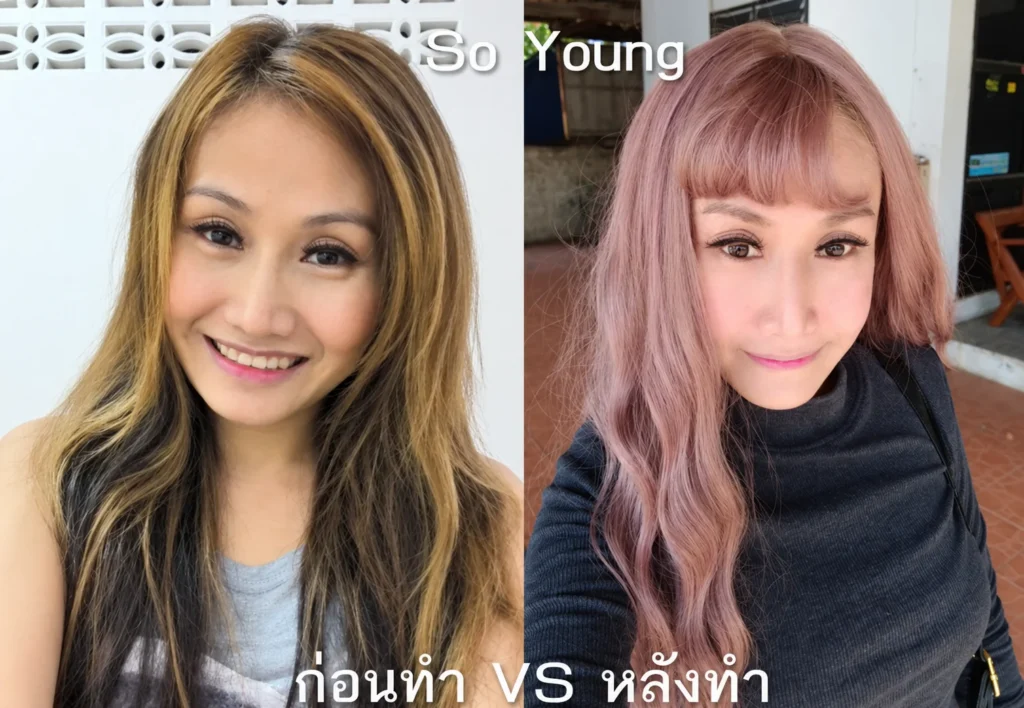 รีวิวยุบโหนกตัดกราม กรอกราม
