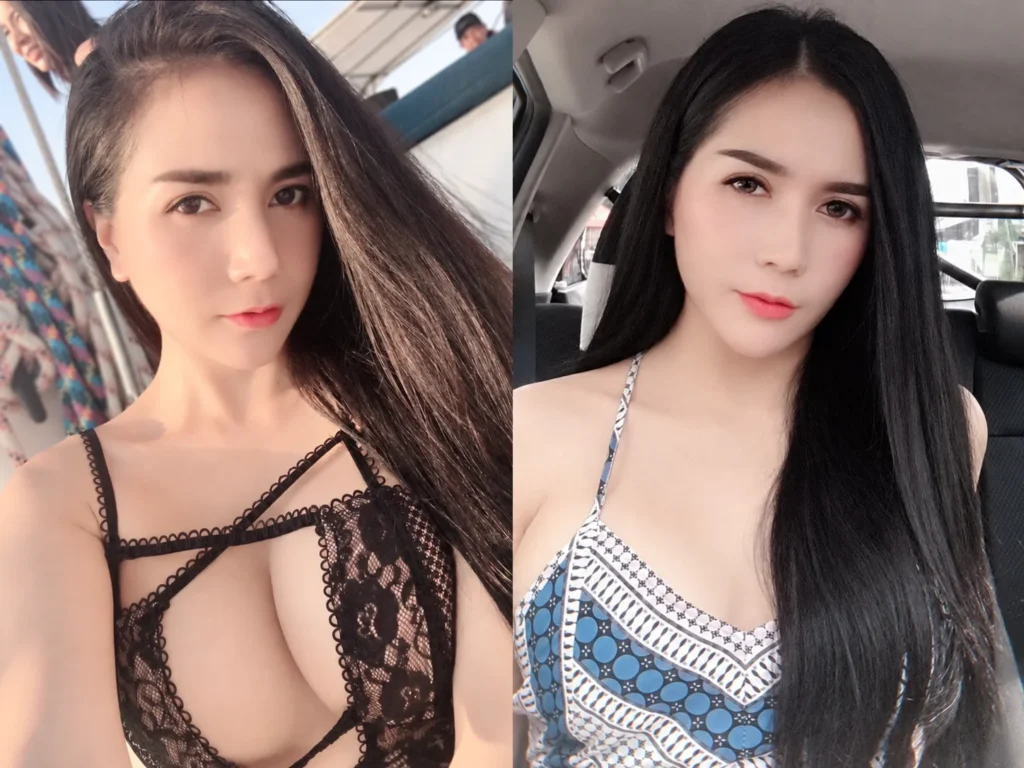 หลังตัดกราม-ยุบโหนกแก้ม