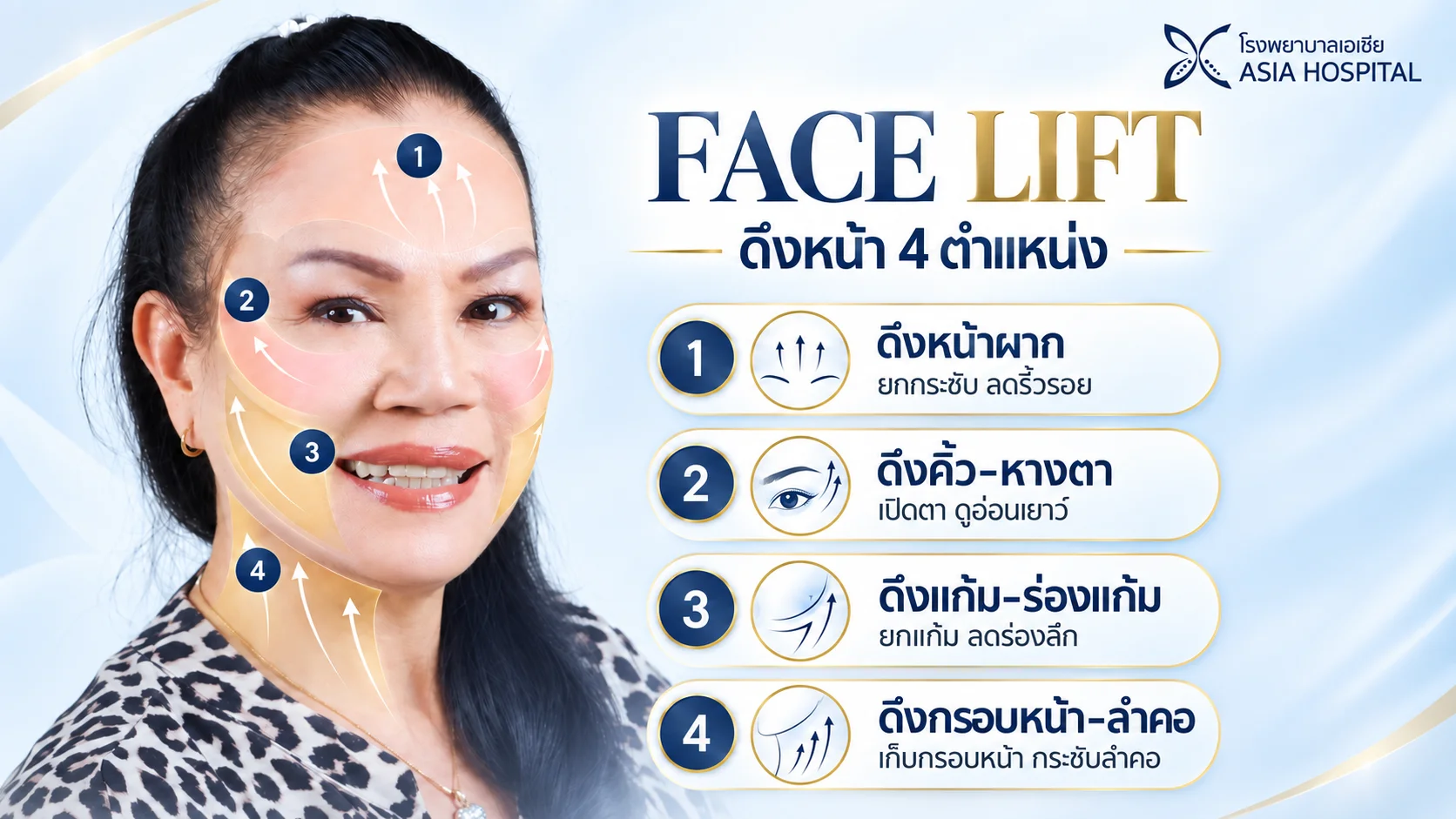 ศัลยกรรมดึงหน้า | โรงพยาบาลเอเซีย | โรงพยาบาลเอเซีย บริเวณที่นิยมดึงหน้า-faceLift-surgery